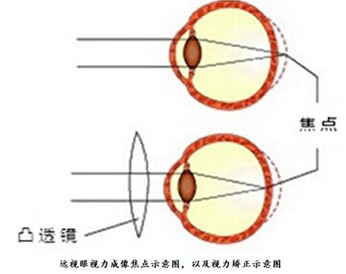 美丽岛渐进多焦老花镜
